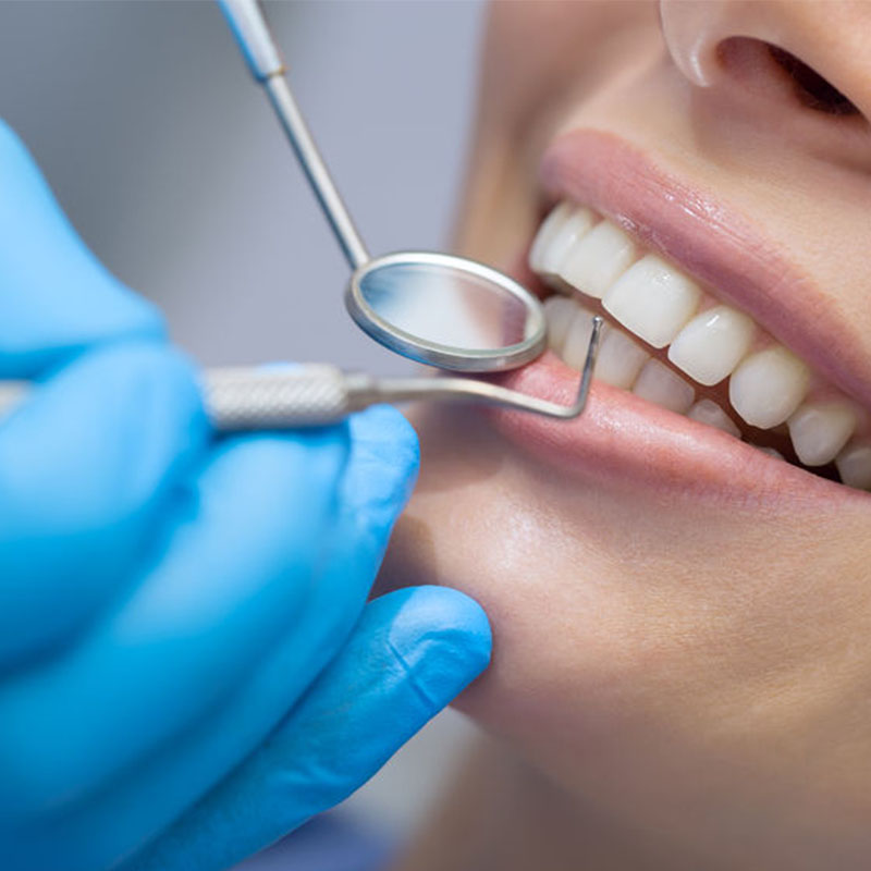 Dental Care at Ecospace, Dental Implants, Root canal treatment in Bellandur